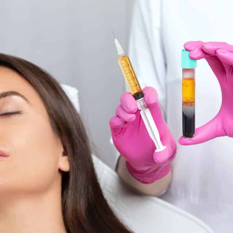 Platelet-Rich Plasma (PRP) offered in Richmond Hill