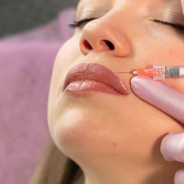 Dermal fillers and lip injections in Richmond Hill.