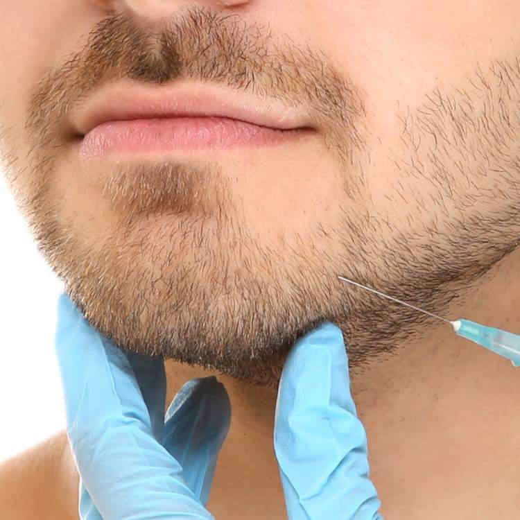PRP Injections for Beard and Face