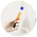 PRP uses your body’s own platelet-rich plasma.